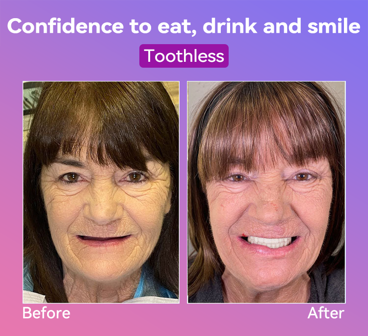 𝐉𝐚𝐬𝐬𝐞𝐞𝐦® Latest Premium Comfort Dentures🎉 (High-End Dentures, Easy to Wear - Limited Time 70% Discount)🔥