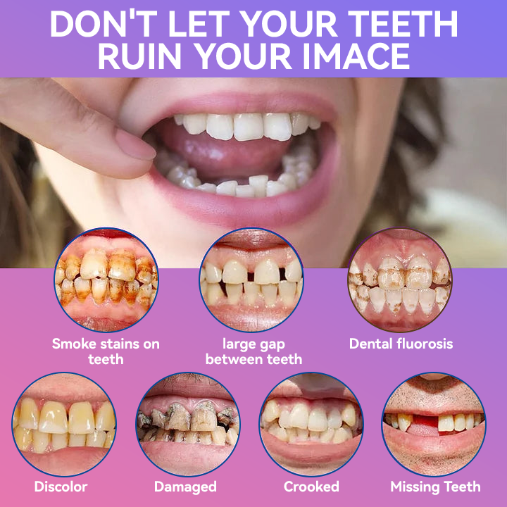 𝐉𝐚𝐬𝐬𝐞𝐞𝐦® Latest Premium Comfort Dentures🎉 (High-End Dentures, Easy to Wear - Limited Time 70% Discount)🔥