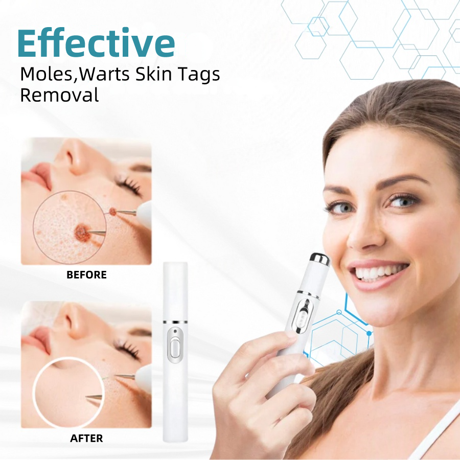 𝐉𝐚𝐬𝐬𝐞𝐞𝐦® Medical-Grade Laser Pen 💕 (Powered by advanced CO₂ laser technology – safely and effectively removes moles, warts, skin tags, pigmentation marks, and other common skin concerns)