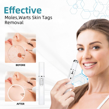 𝐉𝐚𝐬𝐬𝐞𝐞𝐦® Medical-Grade Laser Pen 💕 (Powered by advanced CO₂ laser technology – safely and effectively removes moles, warts, skin tags, pigmentation marks, and other common skin concerns)
