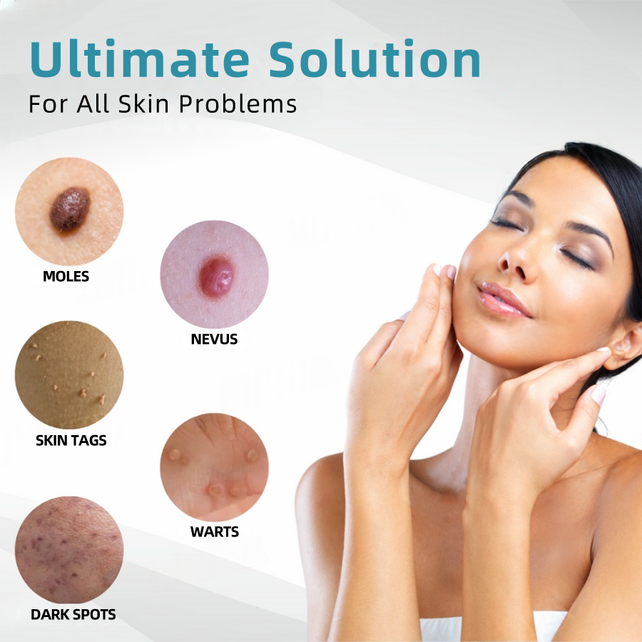𝐉𝐚𝐬𝐬𝐞𝐞𝐦® Medical-Grade Laser Pen 💕 (Powered by advanced CO₂ laser technology – safely and effectively removes moles, warts, skin tags, pigmentation marks, and other common skin concerns)