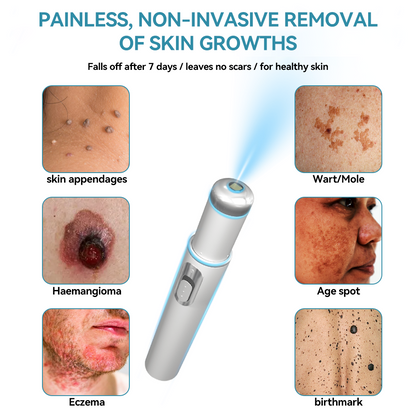 𝐉𝐚𝐬𝐬𝐞𝐞𝐦® Medical-Grade Laser Pen 💕 (Powered by advanced CO₂ laser technology – safely and effectively removes moles, warts, skin tags, pigmentation marks, and other common skin concerns)