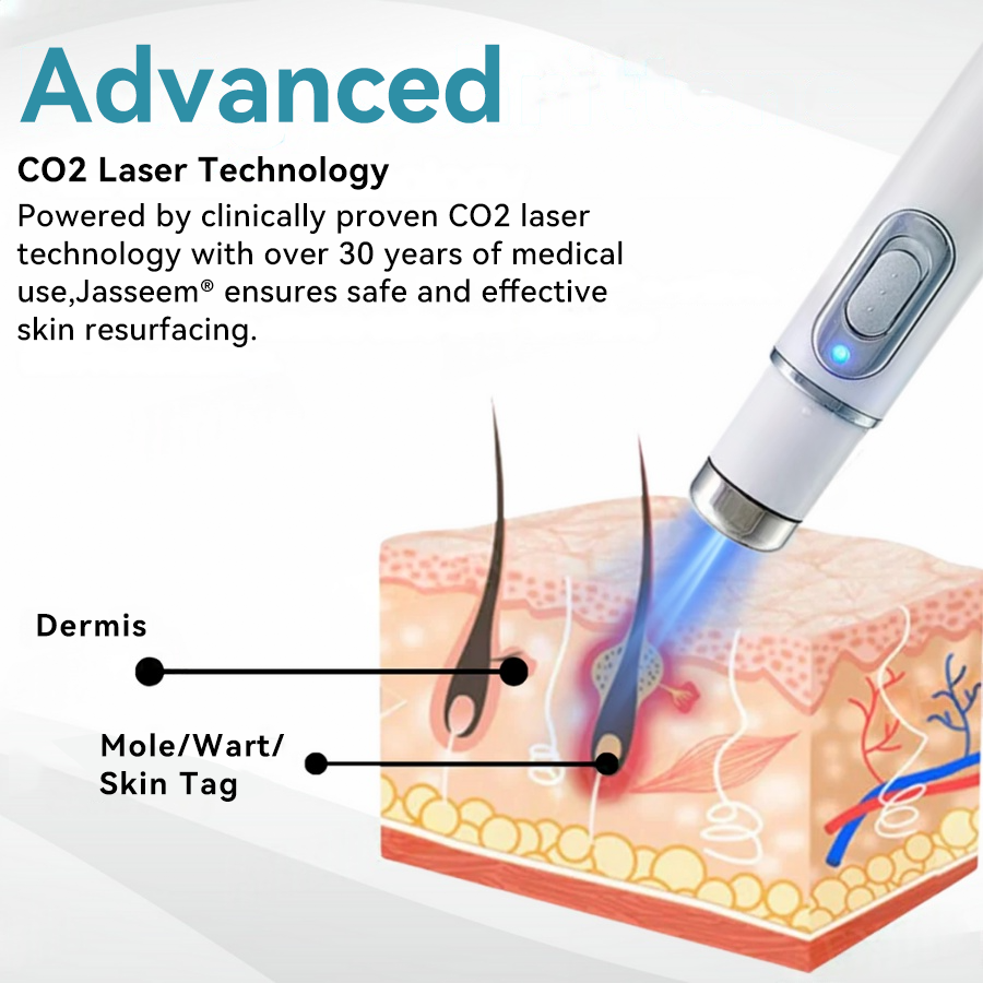 𝐉𝐚𝐬𝐬𝐞𝐞𝐦® Medical-Grade Laser Pen 💕 (Powered by advanced CO₂ laser technology – safely and effectively removes moles, warts, skin tags, pigmentation marks, and other common skin concerns)