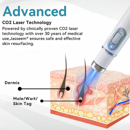 𝐉𝐚𝐬𝐬𝐞𝐞𝐦® Medical-Grade Laser Pen 💕 (Powered by advanced CO₂ laser technology – safely and effectively removes moles, warts, skin tags, pigmentation marks, and other common skin concerns)